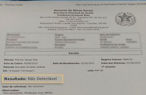 Exame de paciente com suspeita de varíola dos macacos em Muriaé tem resultado negativo