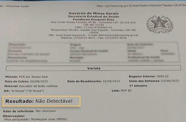 Exame de paciente com suspeita de varíola dos macacos em Muriaé tem resultado negativo
