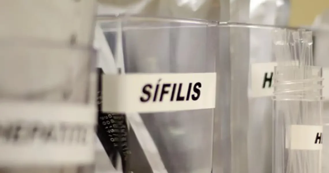 Sífilis continua em ritmo acelerado de crescimento no país