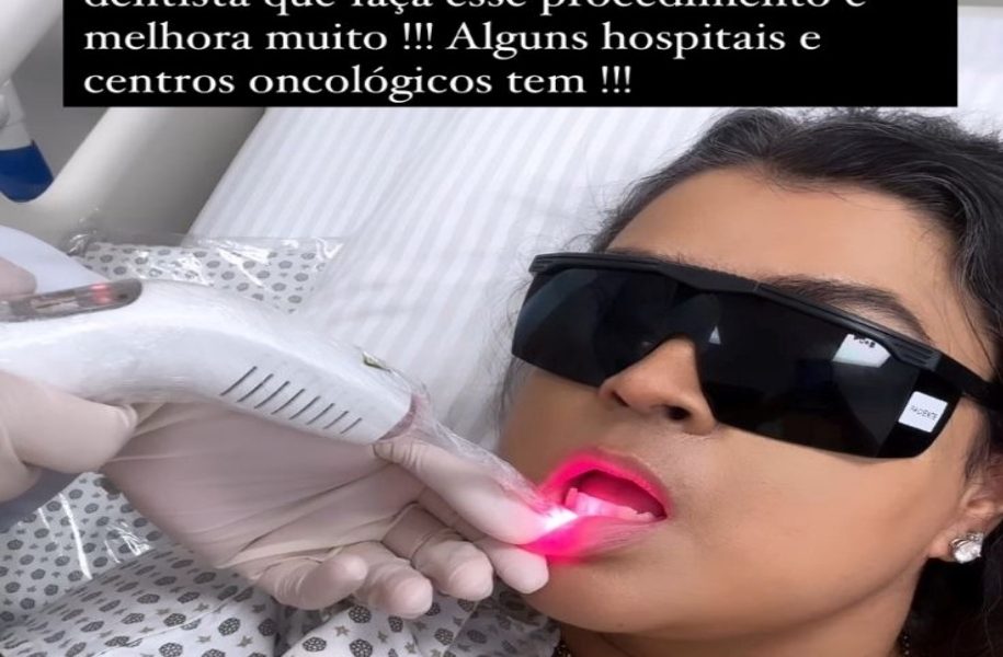 Mucosite: Entenda o que é e como funciona o tratamento odontológico feito por Preta Gil
